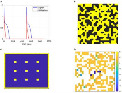 Machine Learning Identification of Pro-arrhythmic Structures in Cardiac Fibrosis